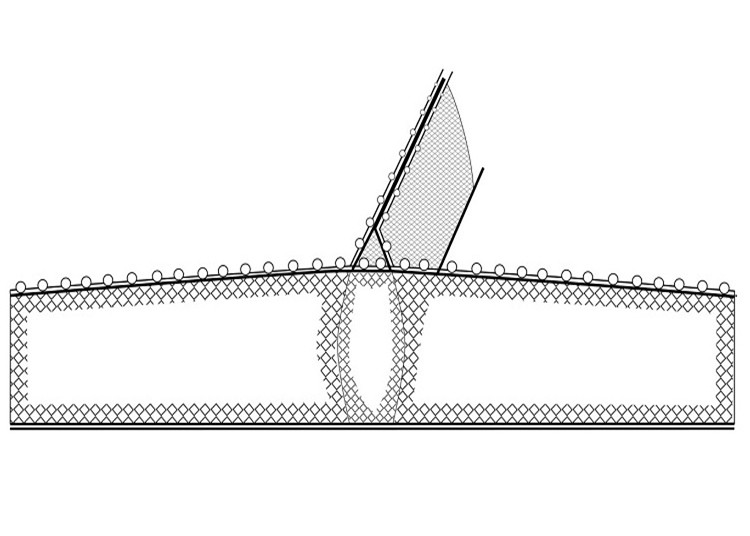 大拉网 有囊大拉网 冰下大拉网 地拉网