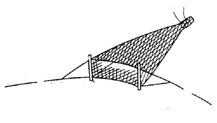 银鱼拖网 搬网 无翼单囊 拖网
